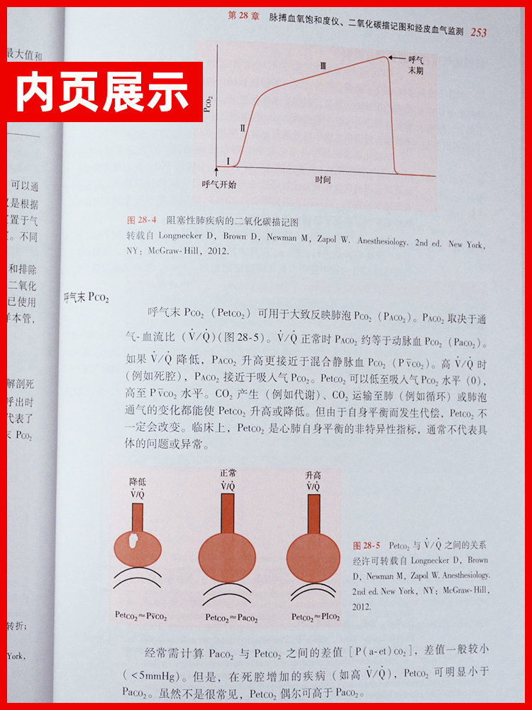 现货 机械通气精要 翻译版第三3版王辰袁月华 成人临床机械通气思路原则原理专业指南书籍呼吸机使用适用于呼吸治疗师和危重症医师 - 图0