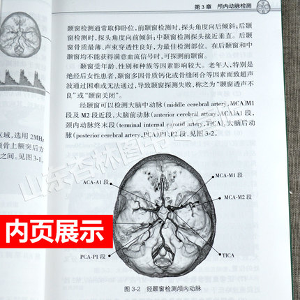 2本套经颅多普勒超声入门与提高+简明经颅多普勒超声诊断初学者规范化培训TCD操作颅外动脉检测流程人卫TCD临床应用操作技术-图2