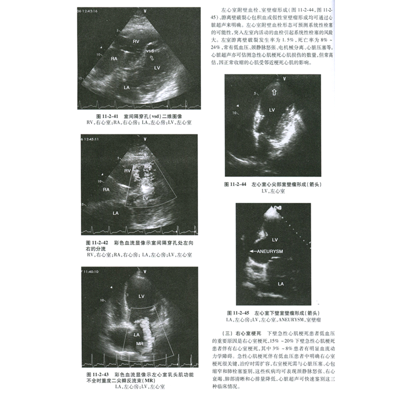 正版临床实用重症医学第2版第二版刘大为主编 实用重症书籍危重症医学教程急诊医学实用适于重症医学内科学急诊科人民卫生出版社 - 图1