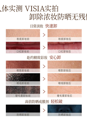 雪玲妃卸妆乳温和清洁卸妆保湿卸妆膏全脸净卸敏感肌适用官方正品