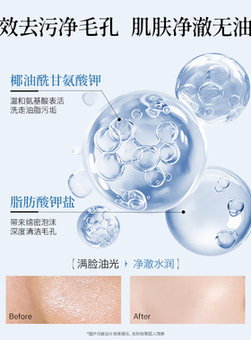 雪玲妃控油净润洗面奶300g