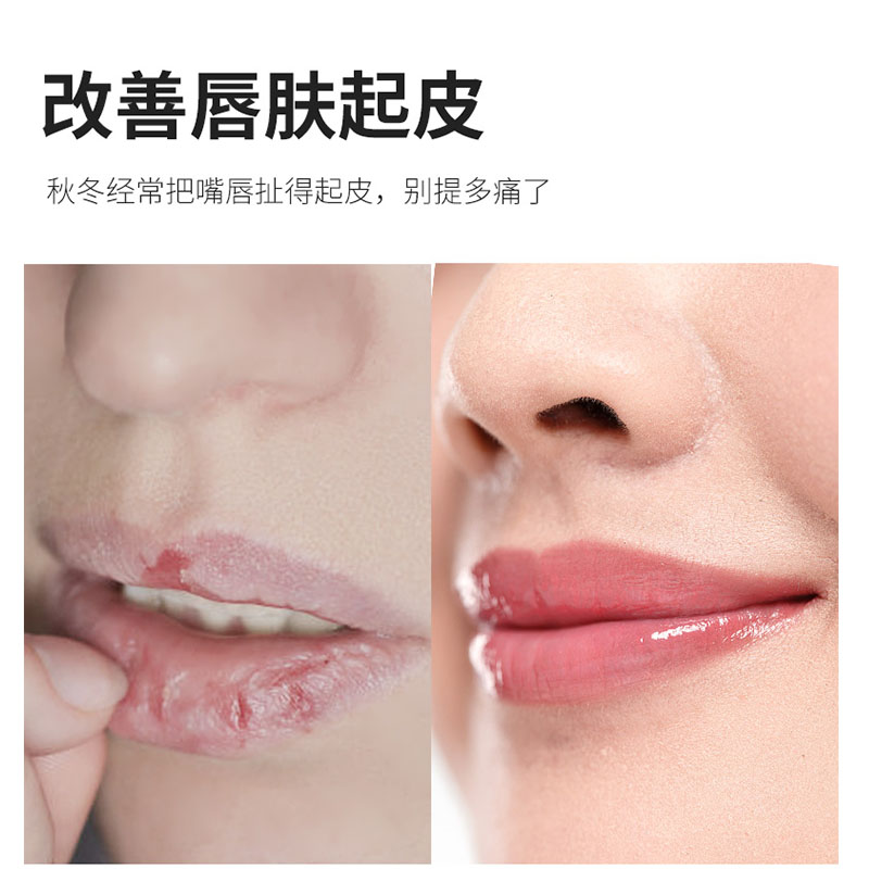 德国原装herbacin贺本清kamille camomile lip balm 小甘菊润唇膏 - 图0