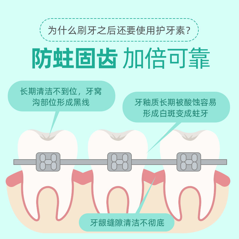 日本狮王龋克菲正畸护牙素含氟牙齿脱矿防护牙齿白斑再矿化啫喱,淘宝优惠券,粉丝福利购,淘宝优惠卷