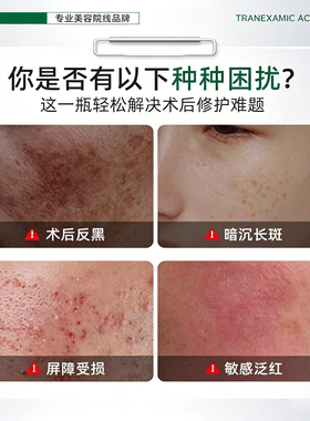 美白祛斑霜祛色斑黄褐斑雀斑提亮