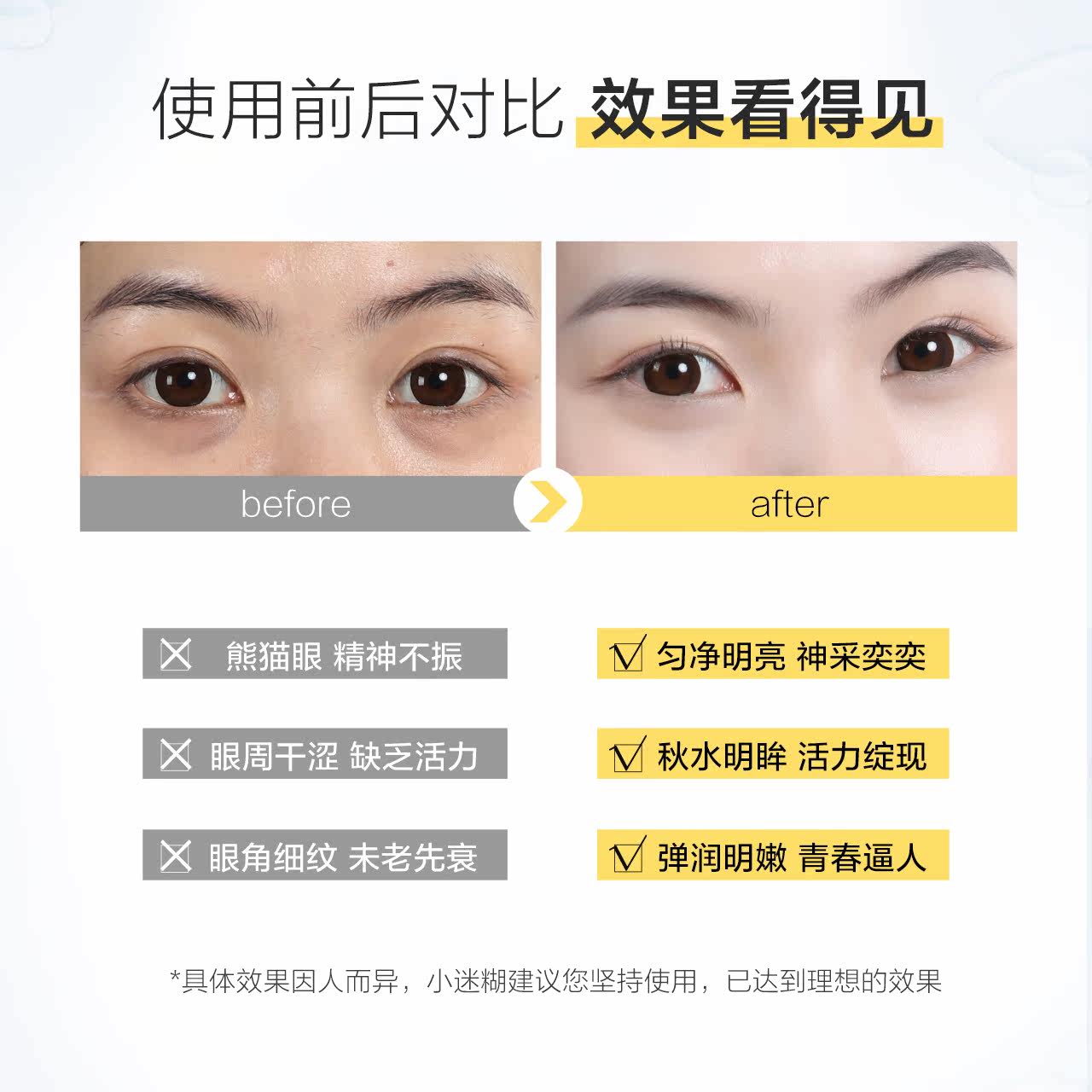 小迷糊烟酰胺眼霜提亮眼周修护眼霜 小迷糊眼霜