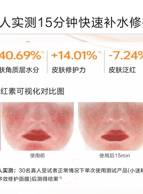 小迷糊修护面膜保湿修护敏肌可用