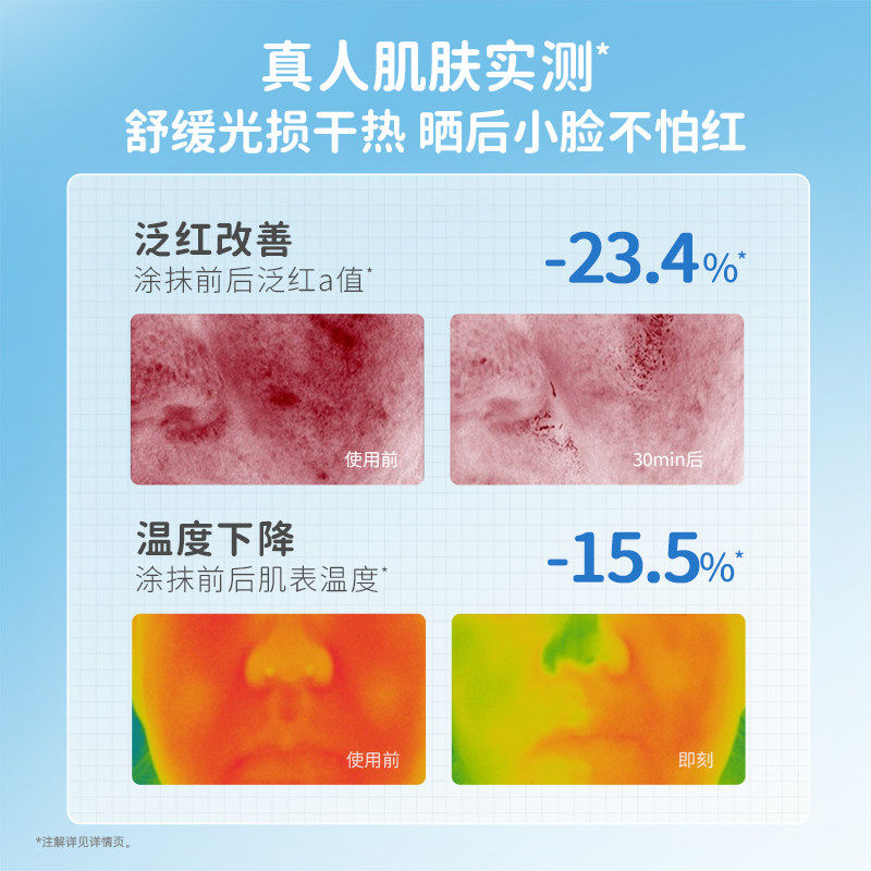 袋鼠妈妈小冰暖霜宝宝儿童面霜补水滋润舒缓婴儿专用护肤官方正品