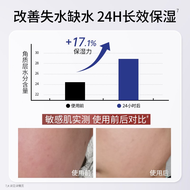 袋鼠妈妈高山火绒草修护精华舒缓精华补水乳敏肌护肤品准孕妇可用 - 图2