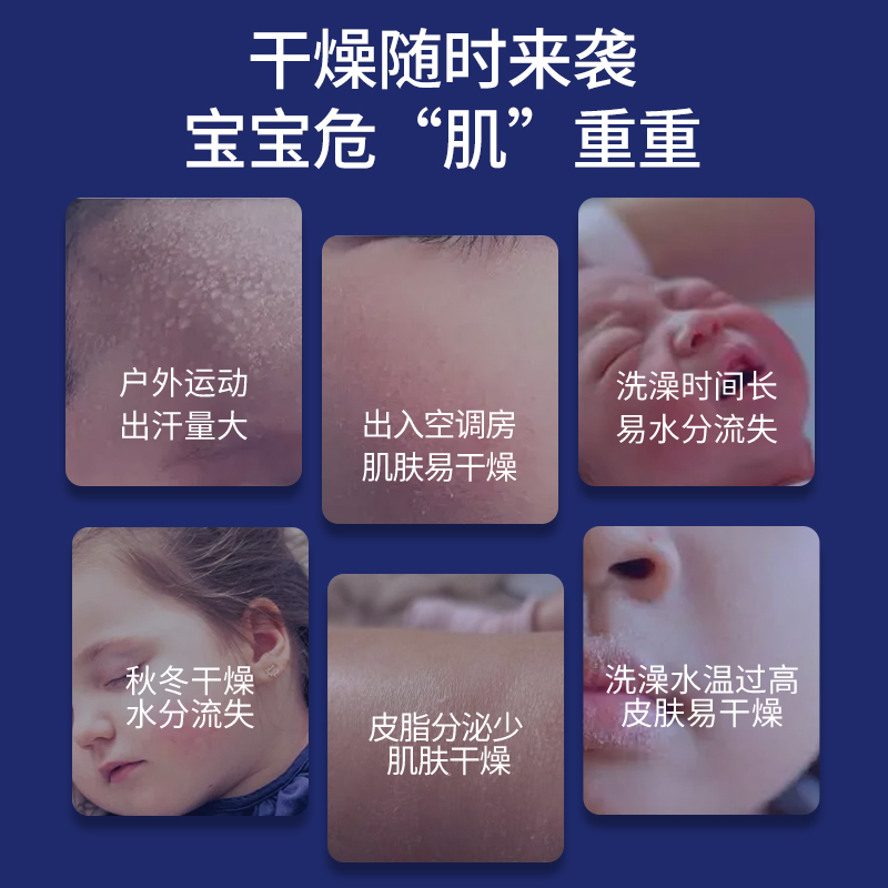 露安适初生安护润肤乳80g幼儿亲肤柔滑肌肤清爽舒缓