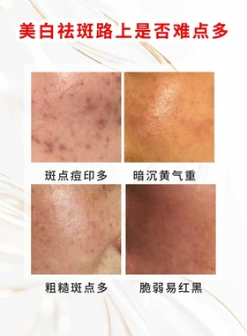 琦色KAYSE美白祛斑四件套 抗皱补水保湿修护水乳精华面霜全套护肤