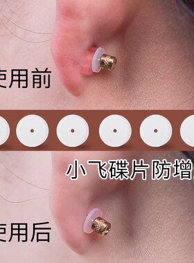 增生医用消除耳骨拯救变形小飞碟