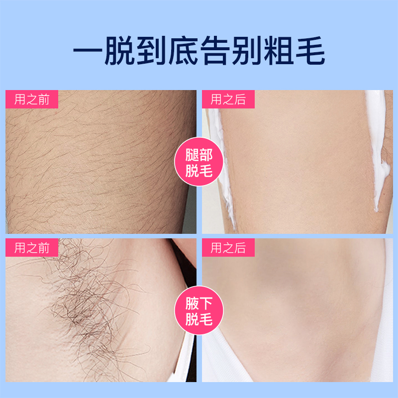 色娜娜旗舰店色娜娜净肤光感脱毛膏腋下私处脱毛泡沫慕斯去毛膏女脱毛修护套装2