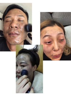超声波美容仪器芦荟导出胶囊超导素三排超导素美容院专用非铅汞毒