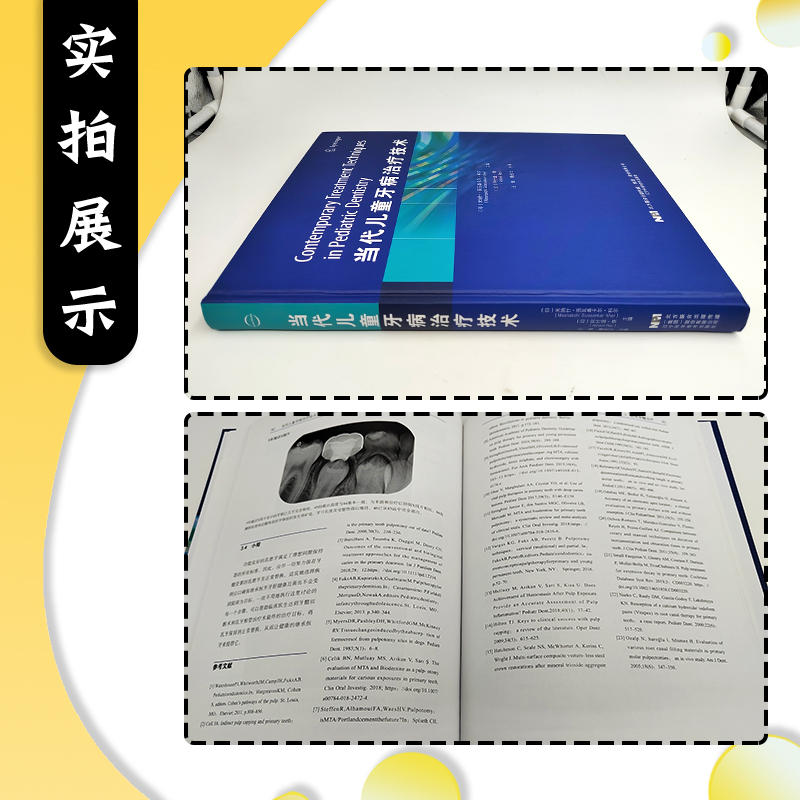 当代儿童牙病治疗技术主译汪俊赖光云牙体牙髓病学临床案例诊治教程辽宁科学技术出版社9787559117021-图1