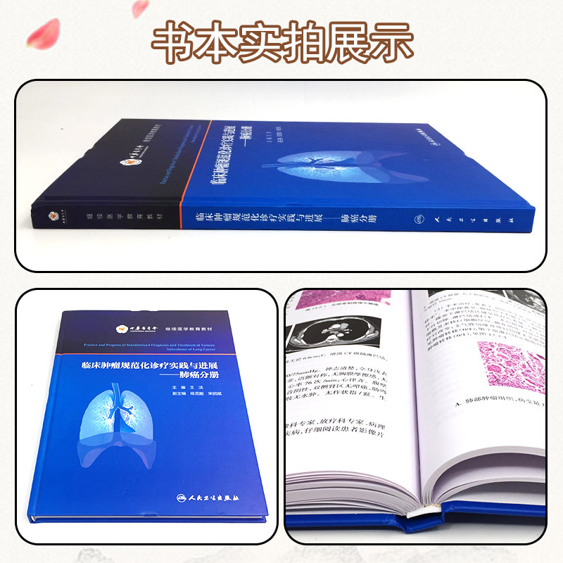 正版 临床肿瘤规范化诊疗实践与进展 肺癌分册 王洁 医院肿瘤肺癌专业诊断治疗外科手术放疗靶向治 人民卫生出版社9787117325509