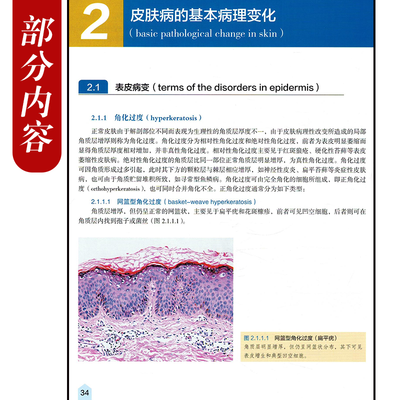正版 皮肤组织病理学入门 皮肤科医生的必备知识第2版 主编高天文 廖文俊 皮肤病学临床案例诊治教程 人民卫生出版社9787117262217