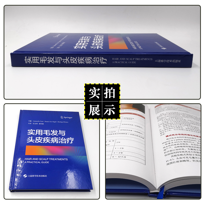 正版 实用毛发与头皮疾病治疗 吴文育 林尽染主译 上海科学技术出版社9787547854488 - 图1