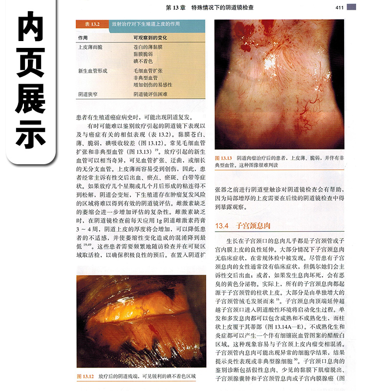 正版 现代阴道镜学第3版 魏丽惠 阴道图片 妇产科阴道镜书籍 妇科阴道镜图谱 妇科书籍 妇科医学书 妇科病书籍 北京大学医学出版社 - 图1