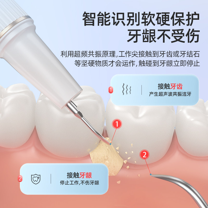 牙结石去除器超声波清洁洗牙机 汇优尚品其它口腔护理设备