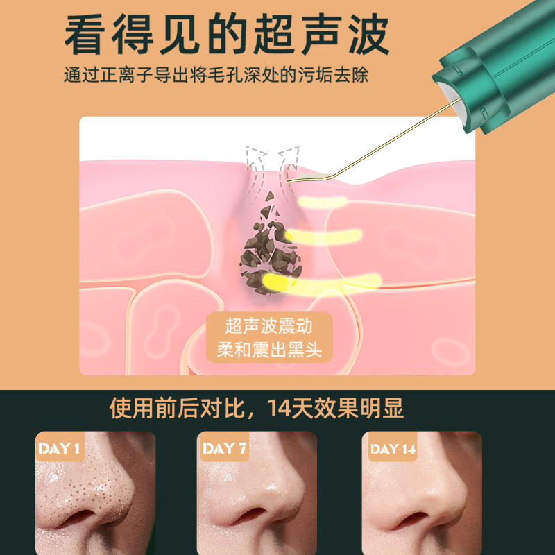 huawei hilink超声波黑头铲清洁 汇优尚品电子美容仪