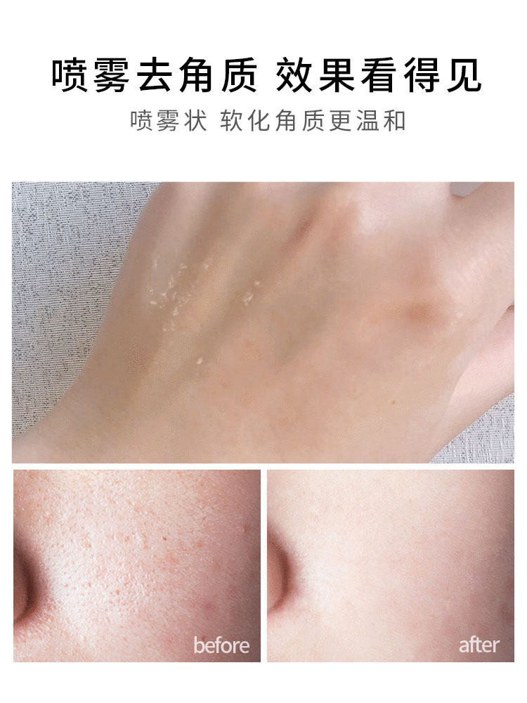 满婷烟酰胺去角质喷雾清洁毛孔光感 manting满婷面部磨砂/去角质