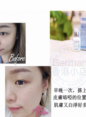 Bicelle净白亮肤精华抗氧活胜肽