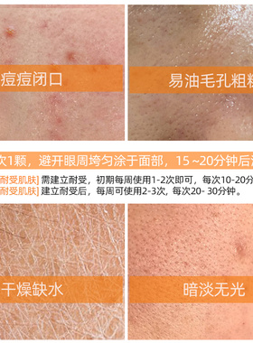 宝龄细腻肤质改善肤质涂抹面膜