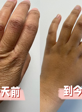 德国正品Glysolid滋润护手霜