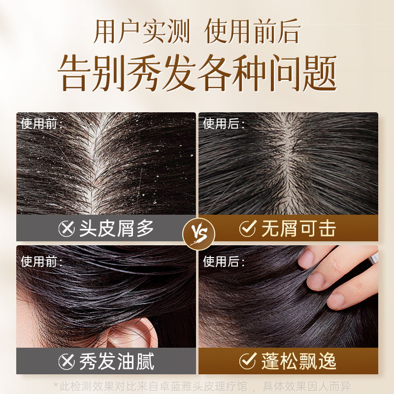 卓蓝雅生姜去屑止痒柔顺洗发水男女舒缓头皮无硅油洗发露旗舰店