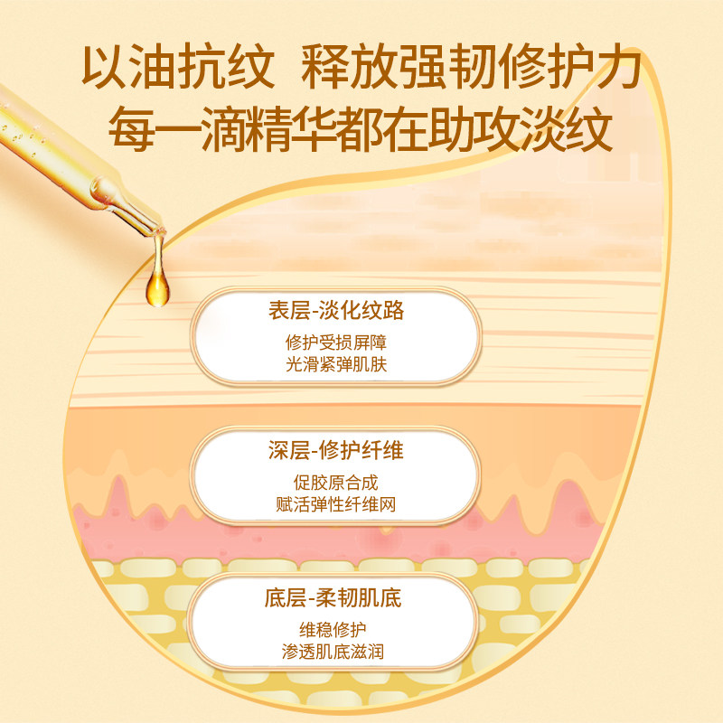 袋鼠妈妈孕妇舒纹修护金熨斗护理油 袋鼠妈妈美韵妊娠纹护理