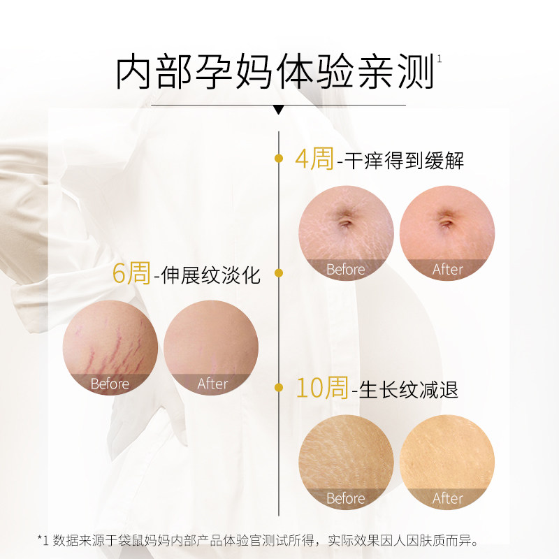 袋鼠妈妈舒纹两件套哺乳孕妇护肤品 袋鼠妈妈美韵妊娠纹护理