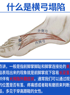 成人足心按摩涌泉穴扁平足矫正鞋