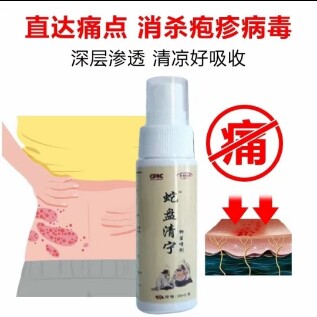 蛇盘清宝带状庖疹神经后遗症痛蛇盘疮瘙痒刺痛灼烧专用消炎止正品 - 图3