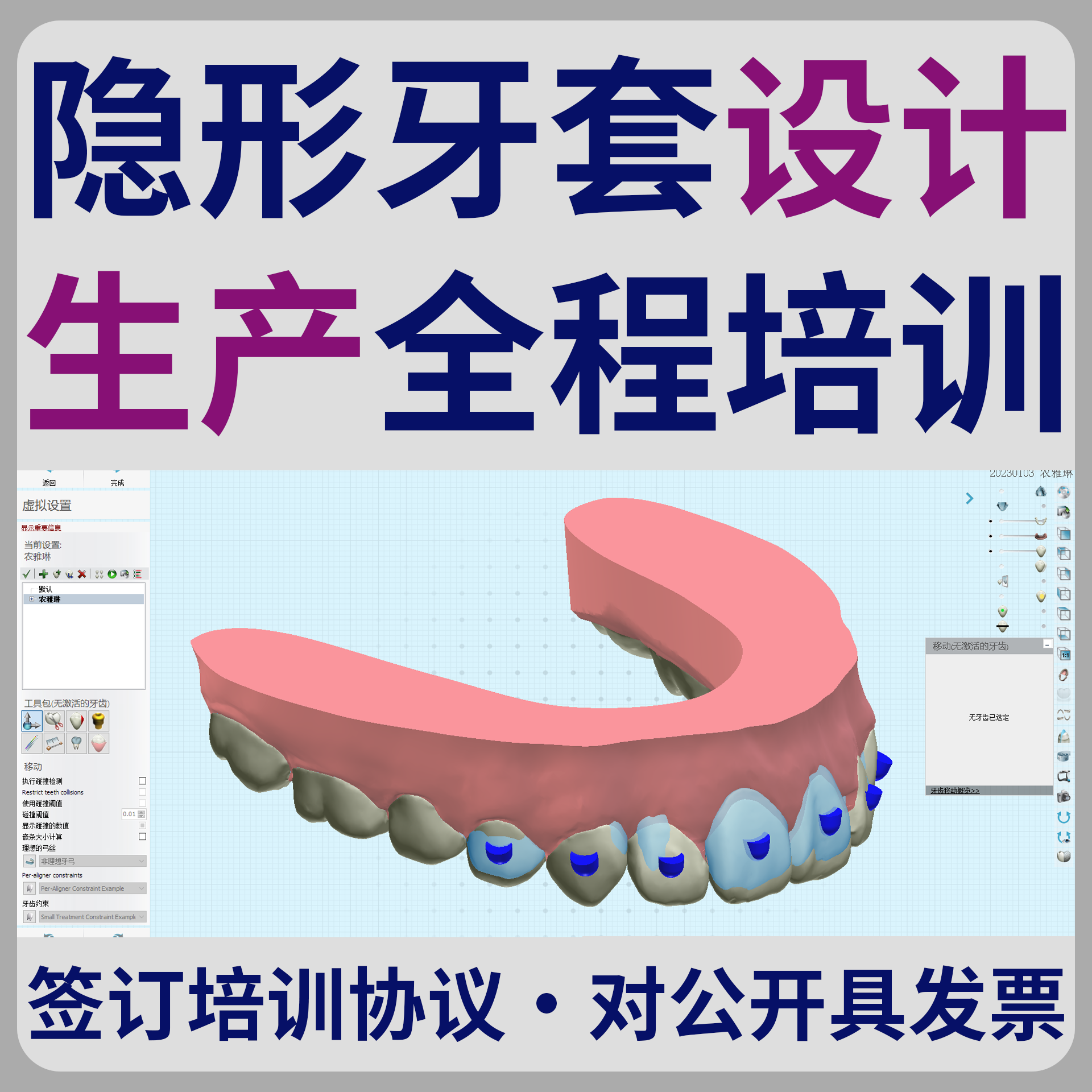 非实物，是数据。隐形牙套动画设计制作方案【2024年4月】 - 图0