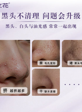 樊文花控油舒缓免撕拉去黑头鼻膜