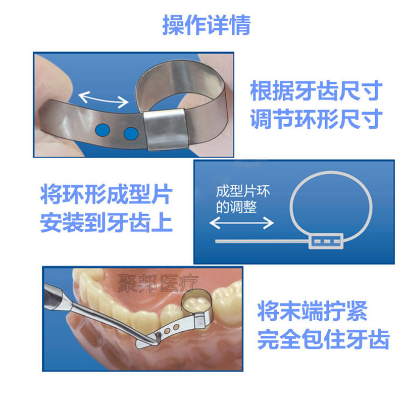 豆瓣成型片套装可调节塑型不锈钢全包裹金属环形俄罗斯牙科成型片 - 图0