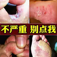 香港脚气药推荐品牌 新人首单立减十元 21年6月 淘宝海外