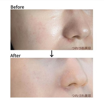 IHADA Sensitive Skin Moisturizing SPF40PA++++ Sunscreen Whitening Powder ຂອງຍີ່ປຸ່ນ ທີ່ມີຮູຂຸມຂົນເບິ່ງບໍ່ເຫັນ ແລະບໍ່ມີຝຸ່ນແຕ່ງໜ້າ
