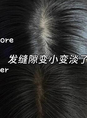 拯救扁塌发际线防水防汗填充神器