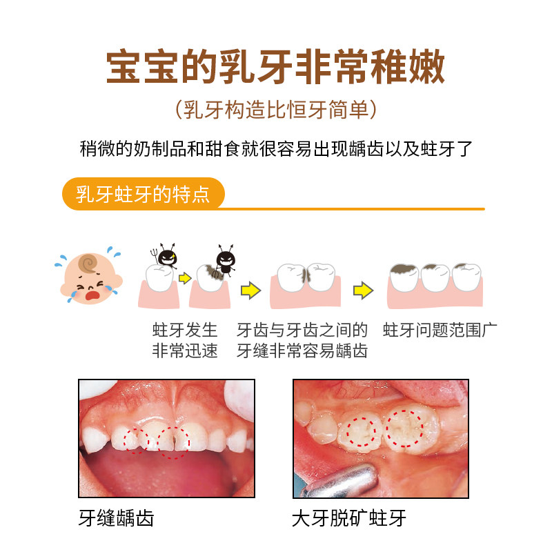 日本拜德乐儿童牙刷迷你小头软毛1岁宝宝专用的小孩6以上防蛀12岁,淘宝优惠券,粉丝福利购,淘宝优惠卷