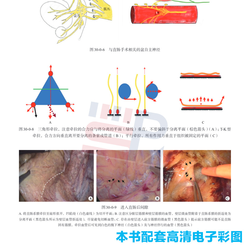 【正版现货】现代肛肠外科学 李春雨 主编肛肠解剖肛肠疾病诊治手术操作手术麻醉术后镇痛肛肠疾病换药护理9787030742018科学出版 - 图3