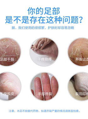 军医生脚裂膏裂可宁足霜正品