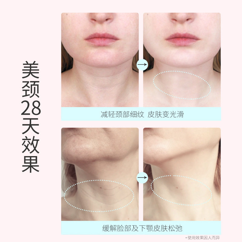 颈部按摩器脸部颈部提拉紧致去法令纹美容仪淡化颈纹去皱美颈,淘宝优惠券,粉丝福利购,淘宝优惠卷