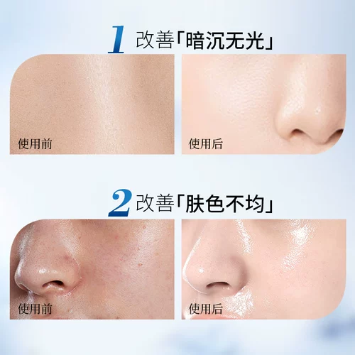 Мужская осветляющая увлажняющая маска для лица содержит никотиновую кислоту, удаление веснушек