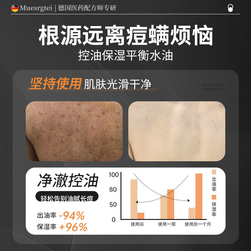 沐浴露男士持久留香正官方品牌除螨乳洗发水二合一套装