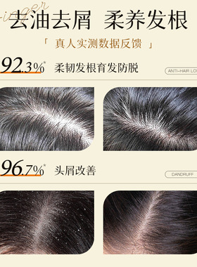 生姜健发洗发水去屑蓬松清爽控油柔顺护根韧滋养头皮防断发正品