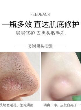 洋甘菊清洁泥膜涂抹式面膜