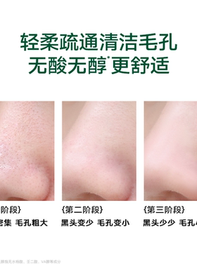 柏翠丝去黑头毛孔紧致修护鼻贴