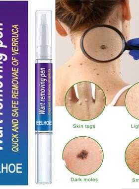 Warts Remover Liquid Antibacterial Ointment Wart Treatment C
