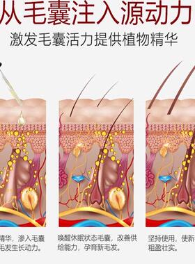 一抹疯长快速胡须胡子生长液精油